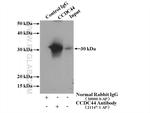 TACO1/CCDC44 Antibody in Immunoprecipitation (IP)