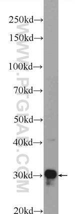 TACO1/CCDC44 Antibody in Western Blot (WB)