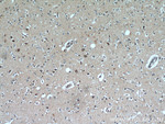 TACO1/CCDC44 Antibody in Immunohistochemistry (Paraffin) (IHC (P))
