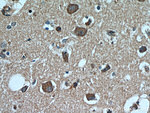 TACO1/CCDC44 Antibody in Immunohistochemistry (Paraffin) (IHC (P))