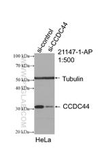 TACO1/CCDC44 Antibody in Western Blot (WB)