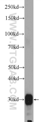 TACO1/CCDC44 Antibody in Western Blot (WB)