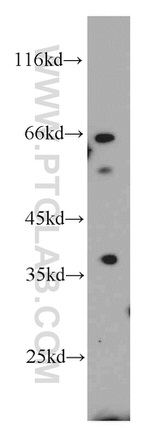 EBF3 Antibody in Western Blot (WB)