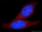 SLITRK6 Antibody in Immunocytochemistry (ICC/IF)