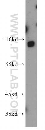 SLITRK6 Antibody in Western Blot (WB)