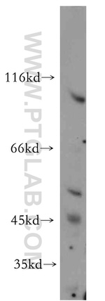 SLITRK6 Antibody in Western Blot (WB)