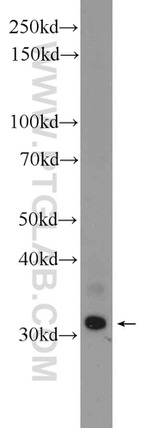 GIYD2 Antibody in Western Blot (WB)