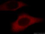 TRIP6 Antibody in Immunocytochemistry (ICC/IF)