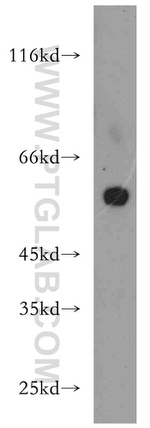 TRIP6 Antibody in Western Blot (WB)