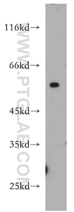 TRIP6 Antibody in Western Blot (WB)