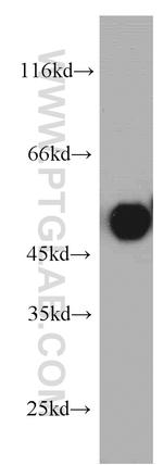 TRIP6 Antibody in Western Blot (WB)