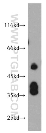 TRIP6 Antibody in Western Blot (WB)