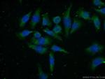 HTR4 Antibody in Immunocytochemistry (ICC/IF)