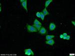 MKL1 Antibody in Immunocytochemistry (ICC/IF)