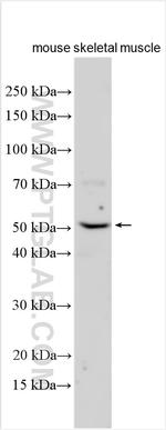 AMDHD1 Antibody in Western Blot (WB)