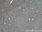 NSF Antibody in Immunohistochemistry (Paraffin) (IHC (P))