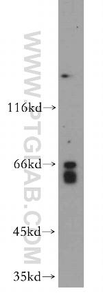 MYLK2 Antibody in Western Blot (WB)