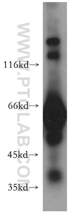 MYLK2 Antibody in Western Blot (WB)