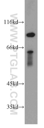 C17orf28 Antibody in Western Blot (WB)