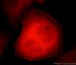 C17orf28 Antibody in Immunocytochemistry (ICC/IF)