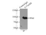 C17orf28 Antibody in Immunoprecipitation (IP)