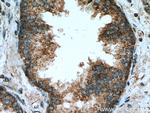 PPM2C Antibody in Immunohistochemistry (Paraffin) (IHC (P))
