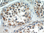 C20orf19 Antibody in Immunohistochemistry (Paraffin) (IHC (P))