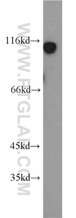 C20orf19 Antibody in Western Blot (WB)