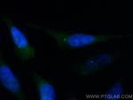 C20orf19 Antibody in Immunocytochemistry (ICC/IF)