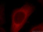 C20orf19 Antibody in Immunocytochemistry (ICC/IF)