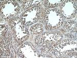 C20orf19 Antibody in Immunohistochemistry (Paraffin) (IHC (P))