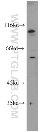 C20orf19 Antibody in Western Blot (WB)
