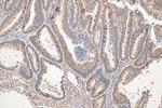 CBLL1 Antibody in Immunohistochemistry (Paraffin) (IHC (P))
