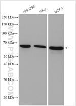 CBLL1 Antibody in Western Blot (WB)