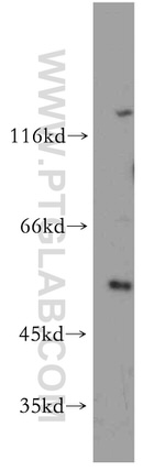 CBLL1 Antibody in Western Blot (WB)
