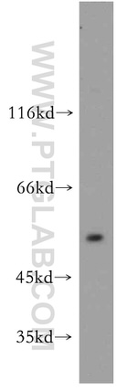 CBLL1 Antibody in Western Blot (WB)