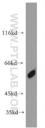 CBLL1 Antibody in Western Blot (WB)