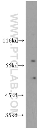 CBLL1 Antibody in Western Blot (WB)