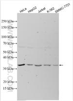 ARHGEF39 Antibody in Western Blot (WB)