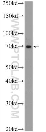 TTC30B Antibody in Western Blot (WB)