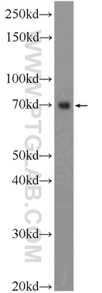 TTC30B Antibody in Western Blot (WB)