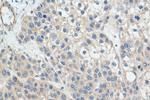 TAOK2 Antibody in Immunohistochemistry (Paraffin) (IHC (P))