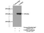TAOK2 Antibody in Immunoprecipitation (IP)