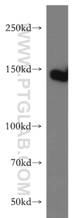 TAOK2 Antibody in Western Blot (WB)