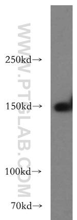TAOK2 Antibody in Western Blot (WB)
