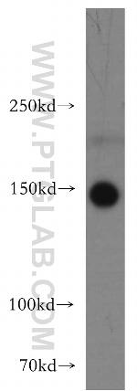 TAOK2 Antibody in Western Blot (WB)