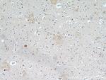 KLHL4 Antibody in Immunohistochemistry (Paraffin) (IHC (P))