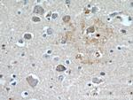 KLHL4 Antibody in Immunohistochemistry (Paraffin) (IHC (P))