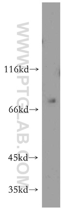 KLHL4 Antibody in Western Blot (WB)