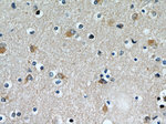STIM2 Antibody in Immunohistochemistry (Paraffin) (IHC (P))